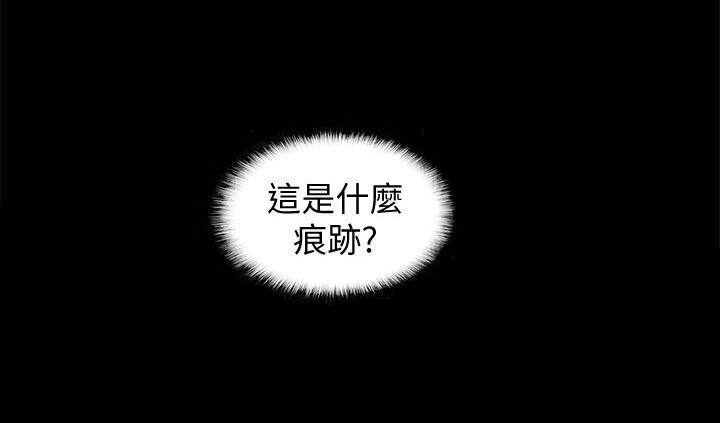 第22章 胸口痕迹-11